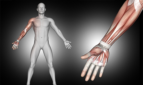 Upper Limb Surgery